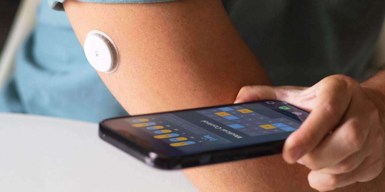 MONITOREO CONTINUO DEL PÁNCREAS, HAZ VISIBLE LO INVISIBLE