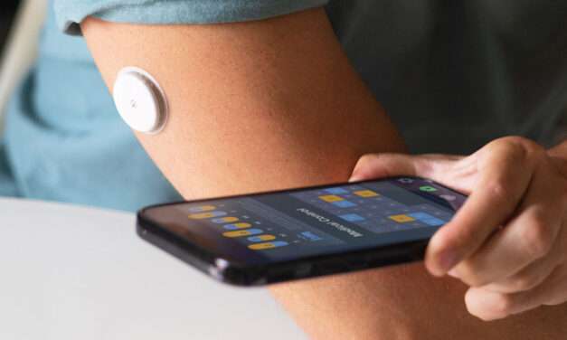 MONITOREO CONTINUO DEL PÁNCREAS, HAZ VISIBLE LO INVISIBLE