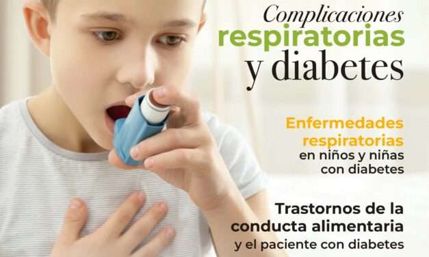 Edición 84